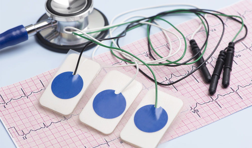 funkcionalnaya diagnostika serdechno sosudistoj sistemy
