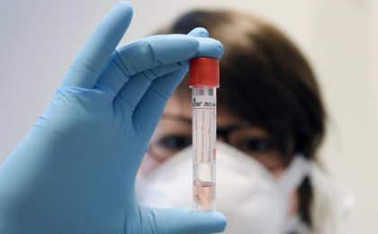 На 16 апреля в Беларуси зарегистрировано 4204 человек с наличием коронавирусной инфекции